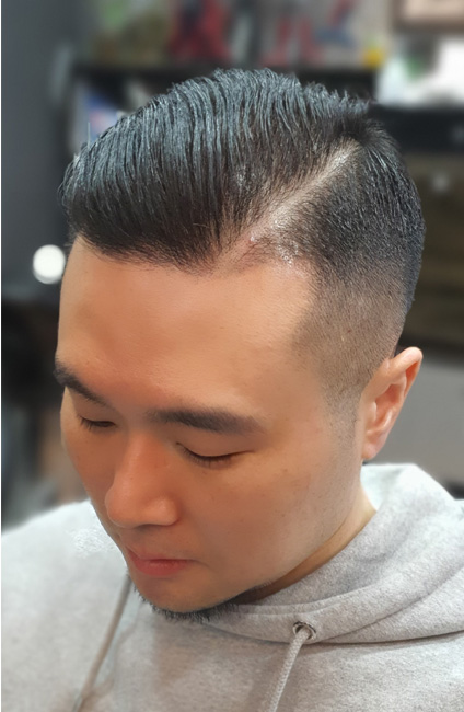 사이드파트 스크래치